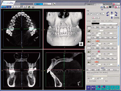 CT診断画像